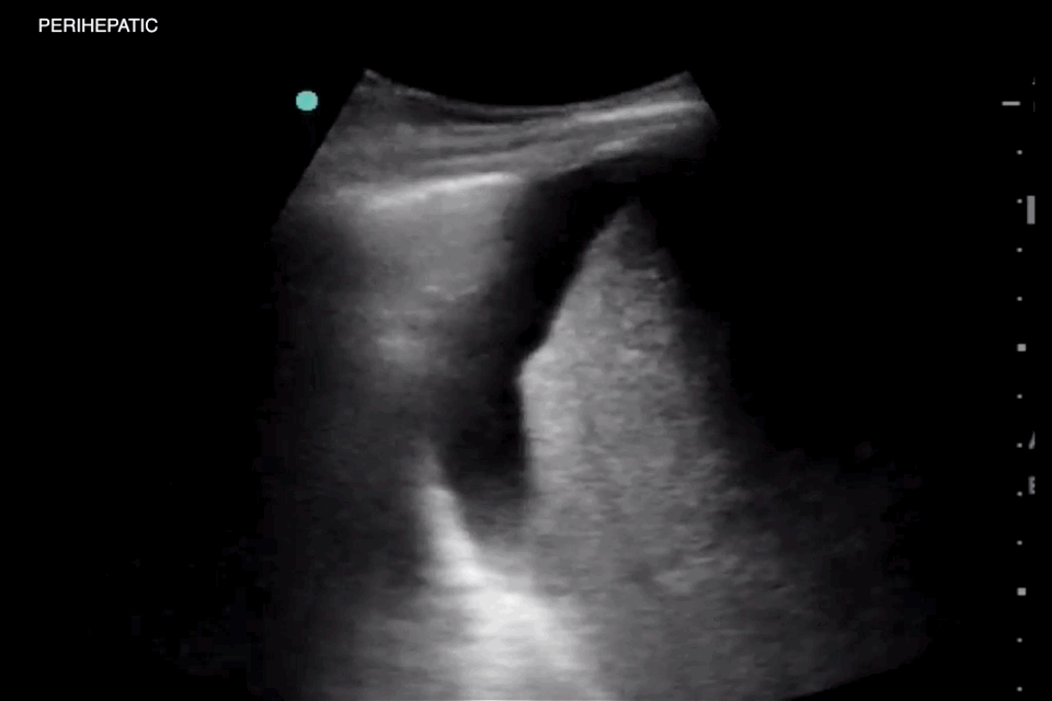 EEU case image missing